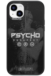 X-Ray - Apple iPhone 15 Plus