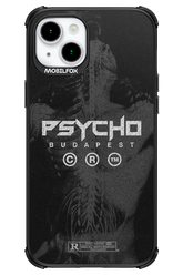X-Ray - Apple iPhone 15 Plus