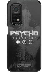 X-Ray - Xiaomi Mi 10T 5G