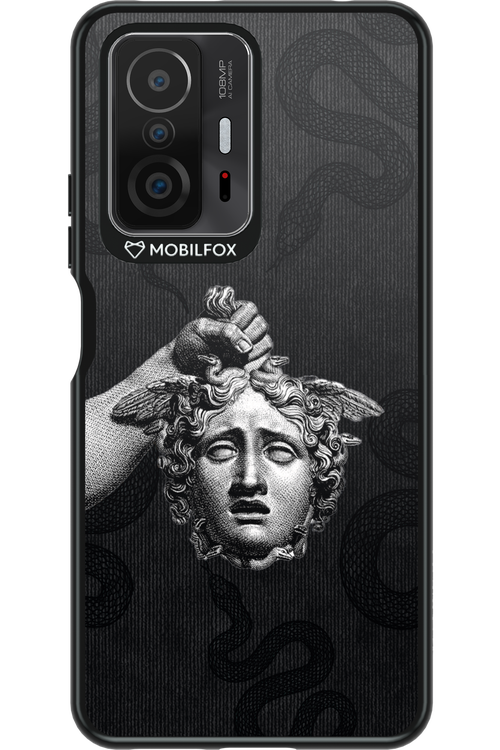 Medusa’s Gaze - Xiaomi Mi 11T