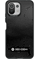 Techno frequency - Xiaomi Mi 11 Lite (2021)