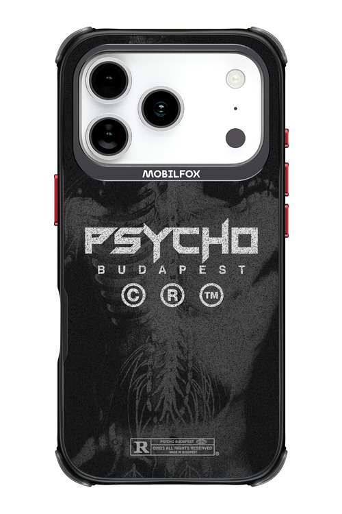 X-Ray - Apple iPhone 17 Pro