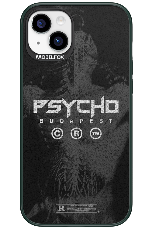 X-Ray - Apple iPhone 15 Plus