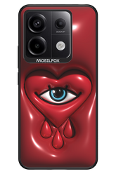 Heart Eye - Xiaomi Redmi Note 13 Pro 5G