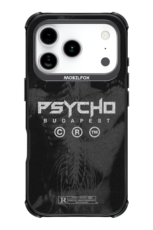 X-Ray - Apple iPhone 17 Pro