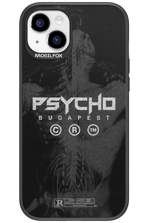 X-Ray - Apple iPhone 15 Plus
