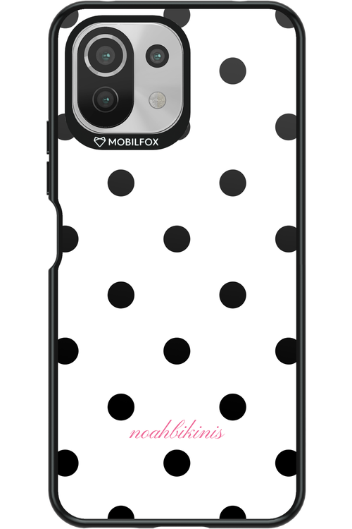 Baby Dots - Xiaomi Mi 11 Lite (2021)