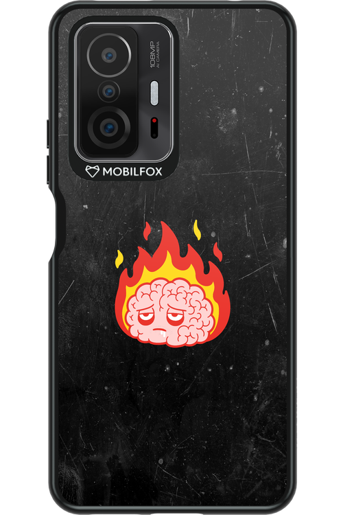 My brain - Xiaomi Mi 11T Pro