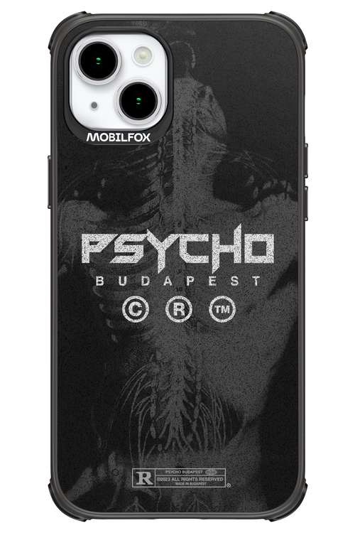 X-Ray - Apple iPhone 15 Plus