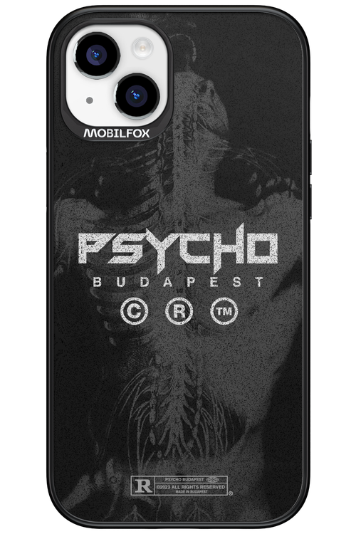 X-Ray - Apple iPhone 15 Plus