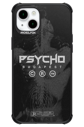X-Ray - Apple iPhone 15 Plus