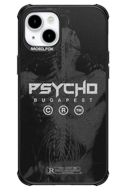 X-Ray - Apple iPhone 15 Plus