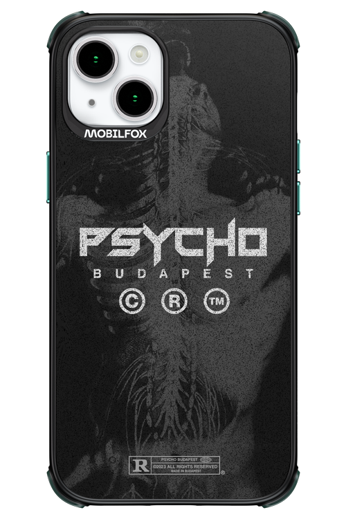 X-Ray - Apple iPhone 15 Plus