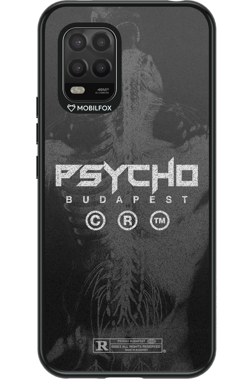 X-Ray - Xiaomi Mi 10 Lite 5G