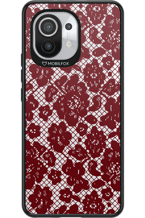 Lace Lover - Xiaomi Mi 11 5G
