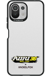 ADRI36 x Mobilfox Edition - Xiaomi Mi 11 Lite (2021)