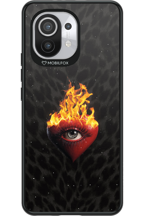 Shit happens - Xiaomi Mi 11 5G