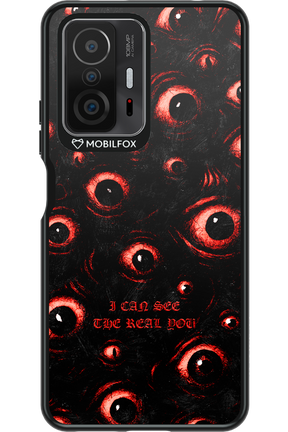 The Watchers - Xiaomi Mi 11T Pro