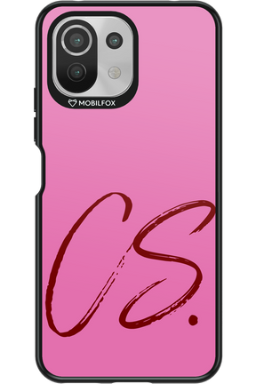 (Sorbet) CS 2.0 - Xiaomi Mi 11 Lite (2021)