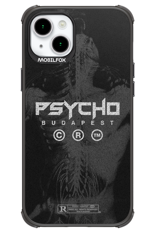 X-Ray - Apple iPhone 15 Plus
