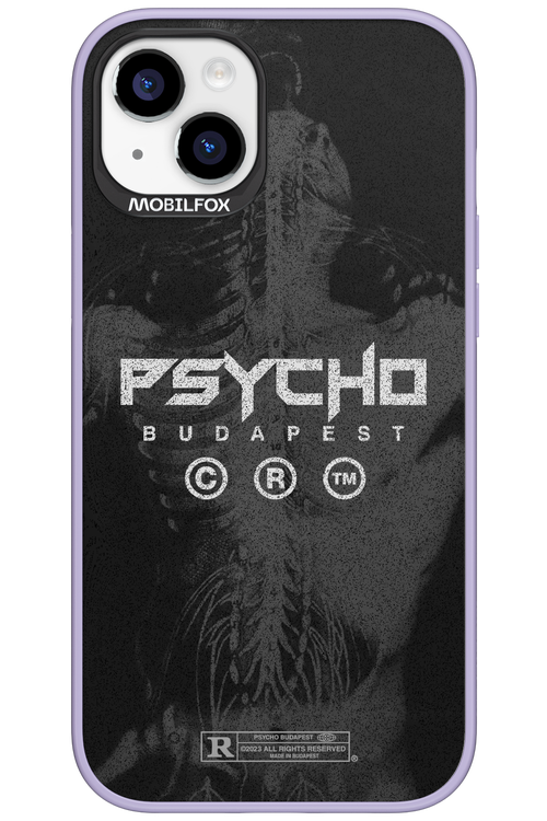 X-Ray - Apple iPhone 15 Plus