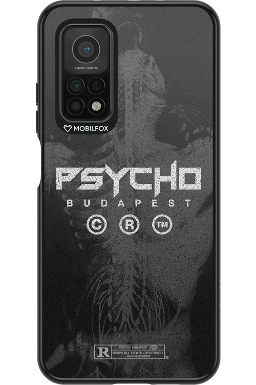 X-Ray - Xiaomi Mi 10T 5G