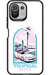 Tropical Speed - Xiaomi Mi 11 Lite (2021)