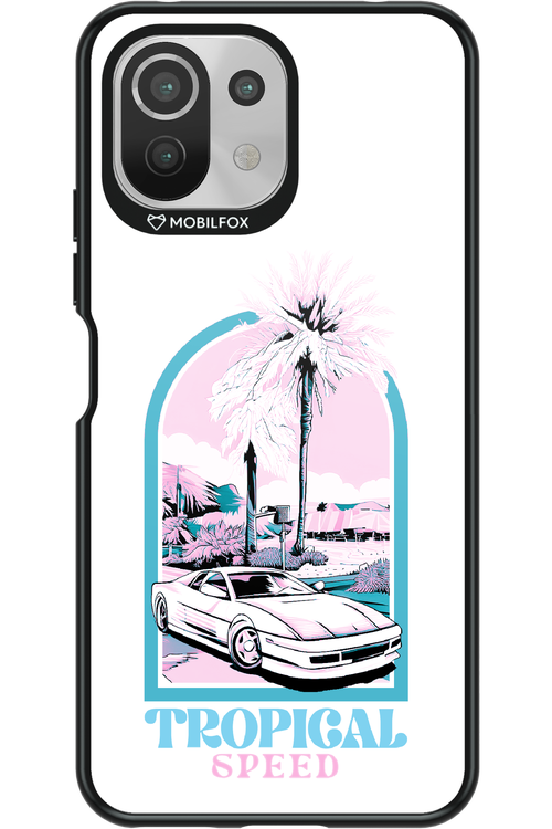 Tropical Speed - Xiaomi Mi 11 Lite (2021)