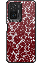 Lace Lover - Xiaomi Mi 11T