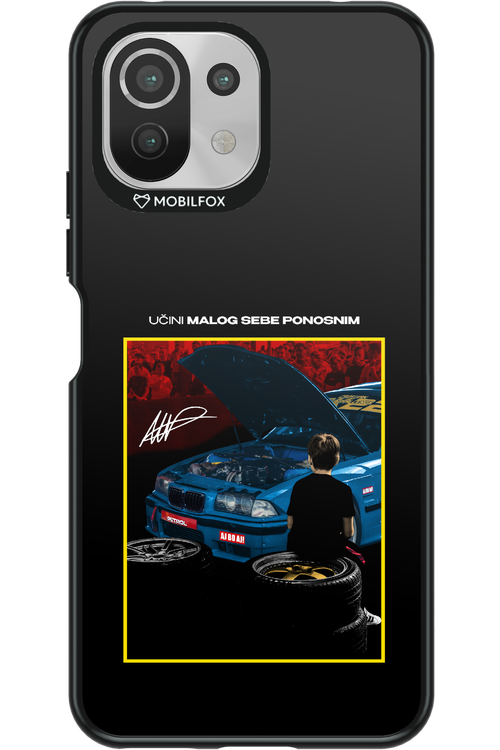 Nova Priprema 2.0 - Xiaomi Mi 11 Lite (2021)