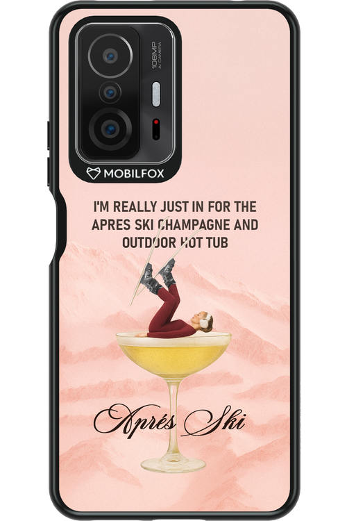 Champagne Tub - Xiaomi Mi 11T