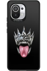 The Diamond King 2.0 - Xiaomi Mi 11 5G