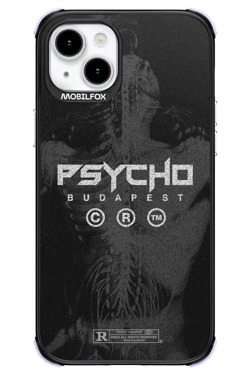 X-Ray - Apple iPhone 15 Plus