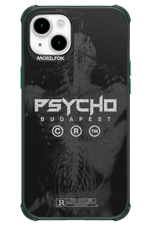 X-Ray - Apple iPhone 15 Plus